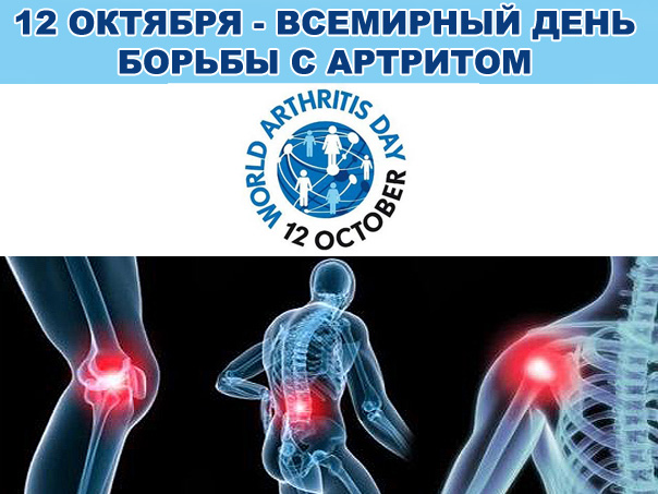 C:UsersUserDesktopартрит.jpg